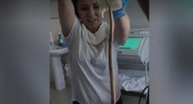 В Дагестане змея заползла в желудок женщине