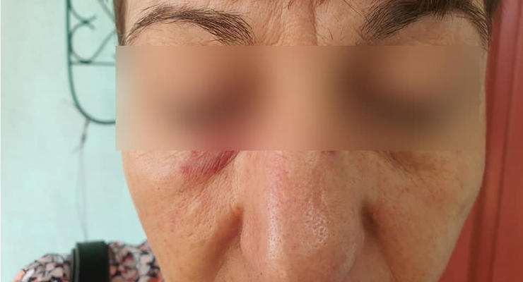 В Сумах пьяная пассажирка избила кондуктора за просьбу надеть маску