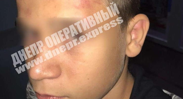 На Днепропетровщине 12-летнего мальчика возле школы избили ромы