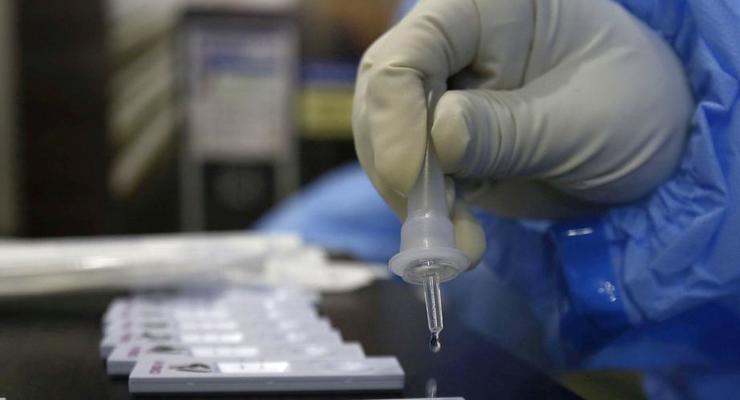 В Украине за сутки от коронавируса умерли 90 человек