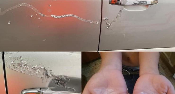 В Киеве хулиганы облили кислотой авто, пострадал ребенок