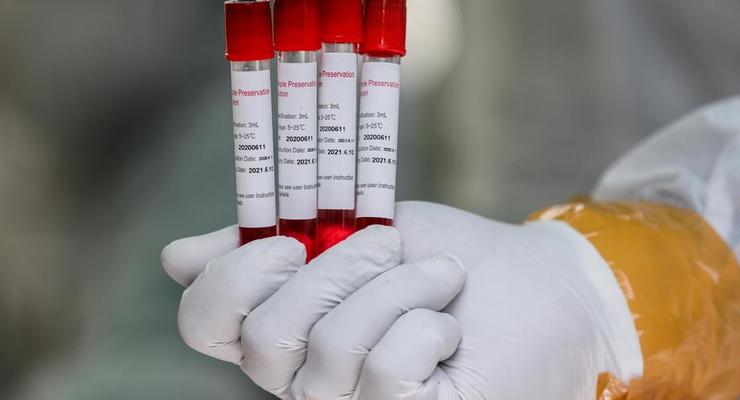 В Украине почти 12 тысяч новых случаев коронавируса