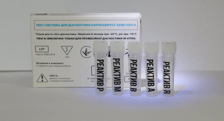 В Украине создали новый ПЦР-тест: Находит COVID и грипп одновременно