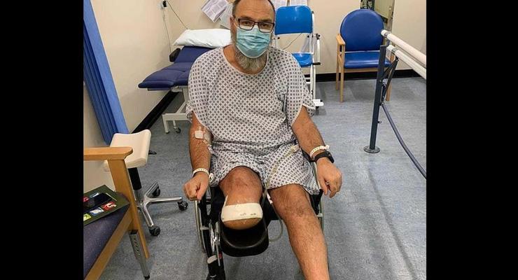Мужчина лишился ноги после того, как заболел COVID-19