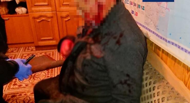 Был под наркотиками: В Борисполе мужчина с ножом порезал отца