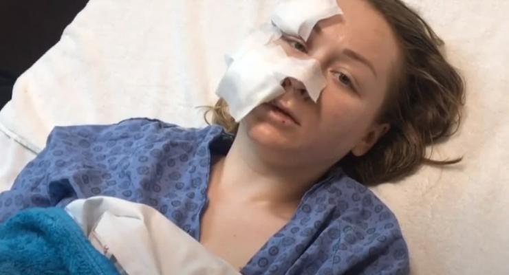В Турции муж-ревнивец изуродовал ножом лицо 28-летней украинки