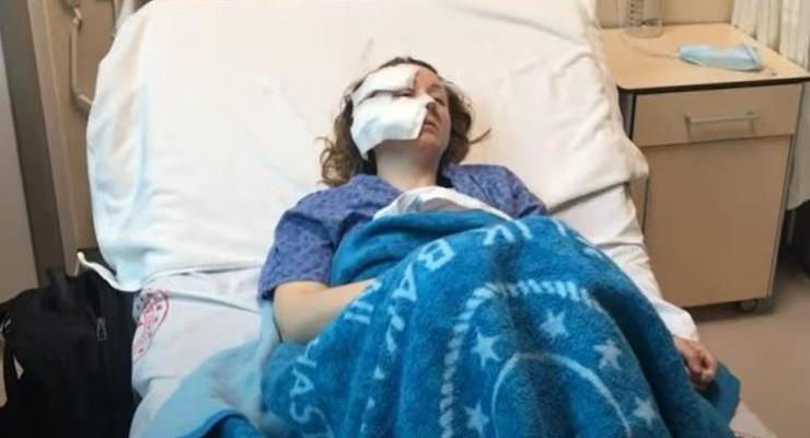 В Турции бывший муж изрезал ножом лицо украинке