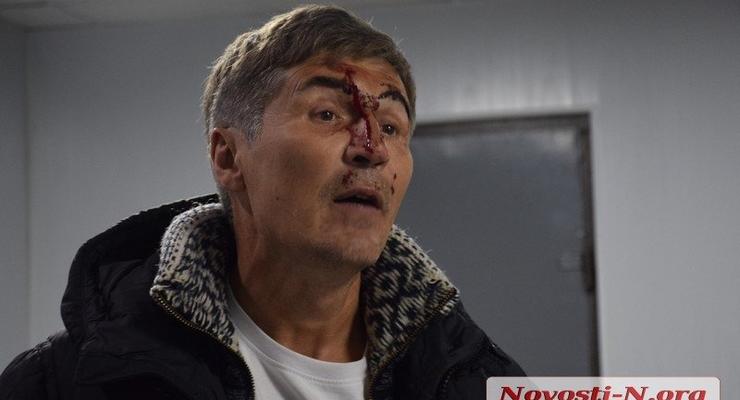 Разбитое в кровь лицо: В Николаеве экс-нардеп подрался с полицией