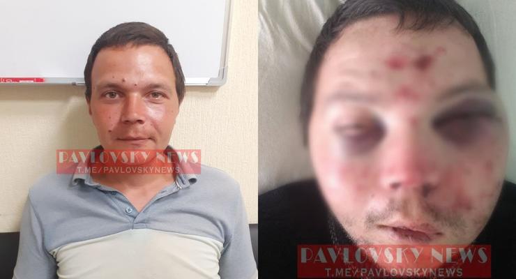 В Киеве трое неизвестных жестоко избили таксиста