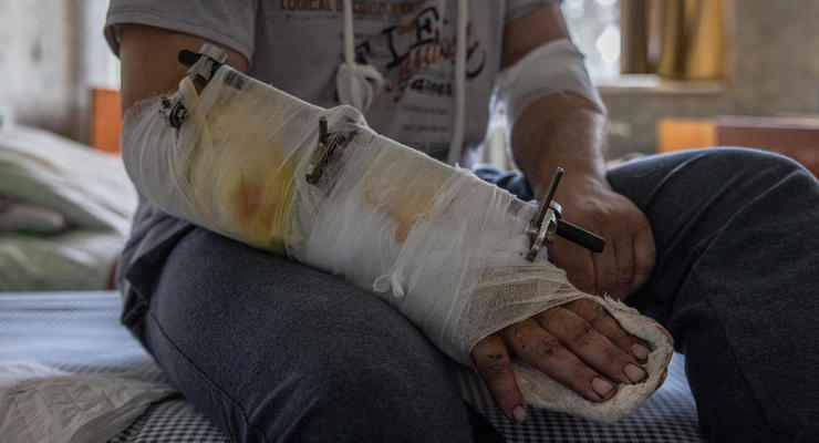 На Луганщині лікарні переповнені російськими окупантами
