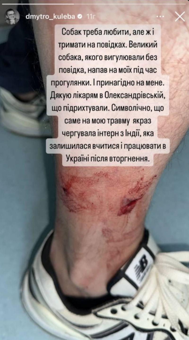 На Дмитрия Кулебу напала собака и прокусила ногу / instagram.com
