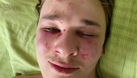 Закарпатский ТЦК опроверг жестокое обращение с мобилизованным, который пытался сбежать из страны