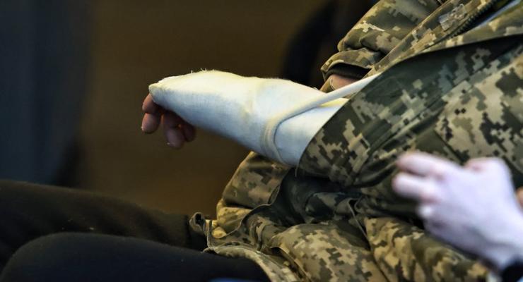 Чи можна отримати відстрочку від мобілізації через перелом руки: відповідь адвоката